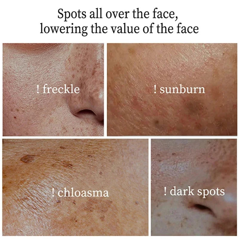 Fast-Acting Dark Spot Corrector