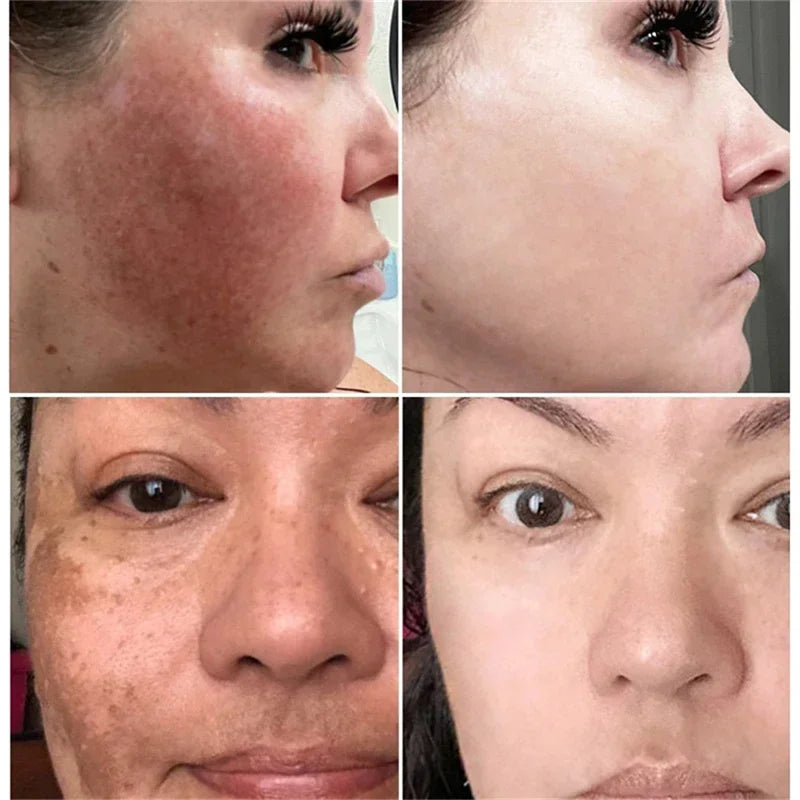 Fast-Acting Dark Spot Corrector
