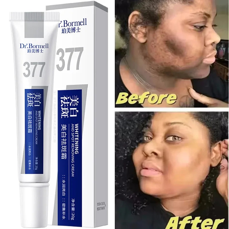 Fast-Acting Dark Spot Corrector