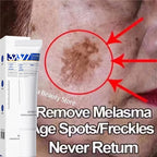 Fast-Acting Dark Spot Corrector
